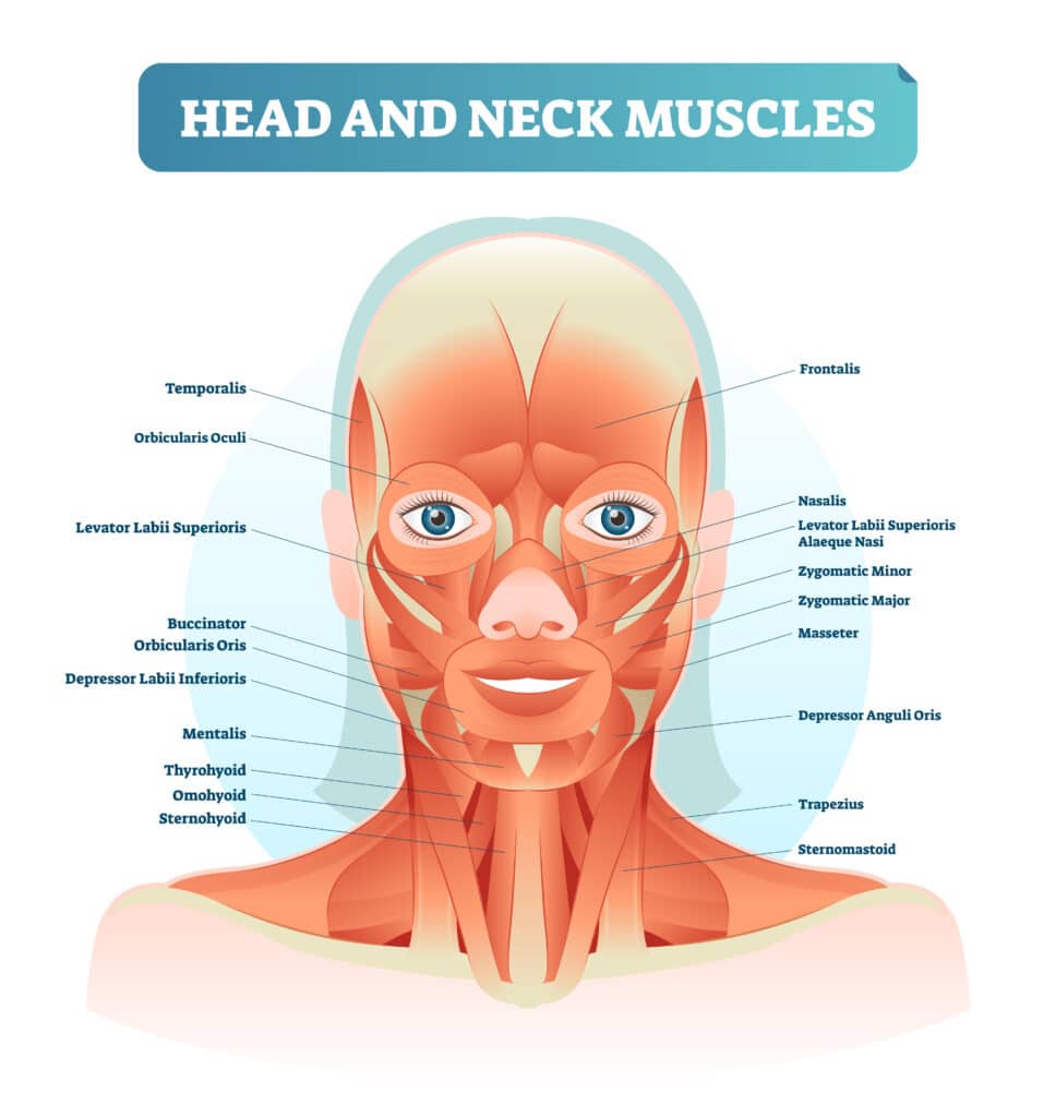 Graphic of the face and neck muscles, some of which contribute to a crick in the neck.
