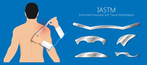 What Is The Graston Technique? - Physio Ed.