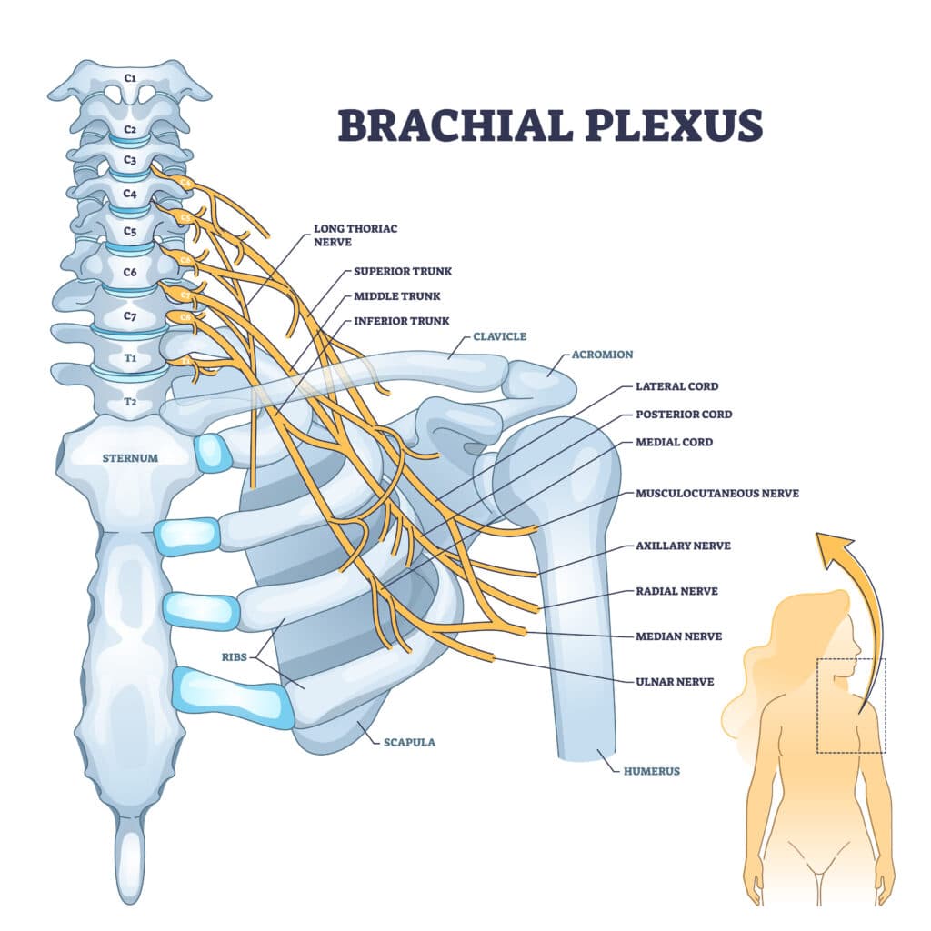 Pinched nerve in the shoulder: Graphic of the human brachial plexus