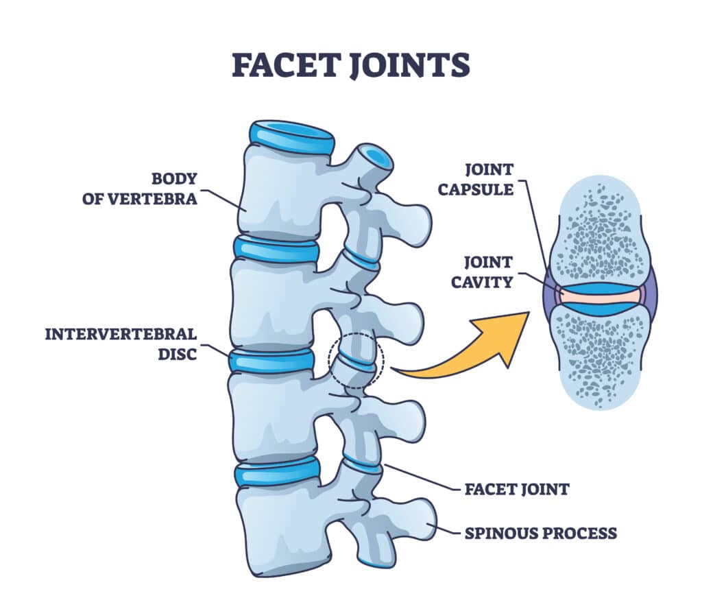 Graphic of the vertebrae facet joints.