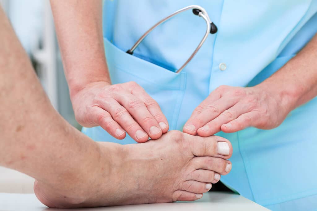 Image of a doctor assessing a patient's bunion on their right foot.