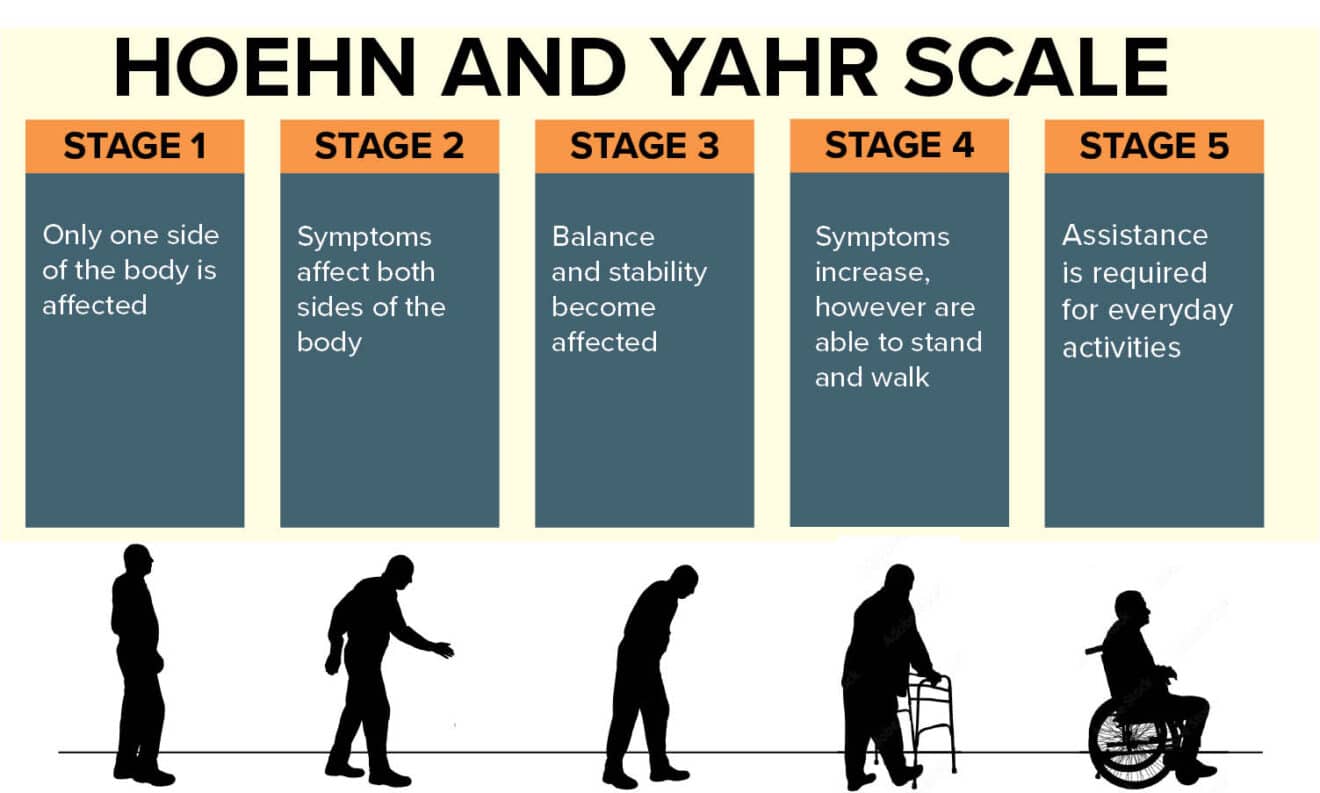 The Five Stages Of Parkinson's Disease - Physio Ed.