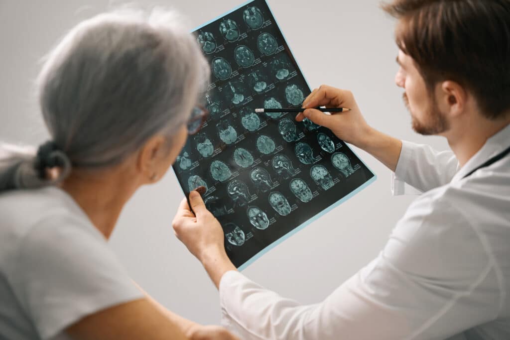Image of a doctor and a senior patient examining a brain scan while discussing unusual stroke symptoms