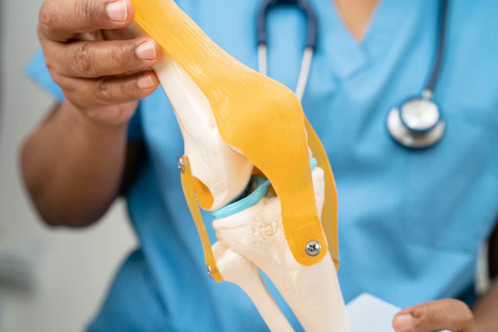 Image of a model knee joint held by a doctor in closeup