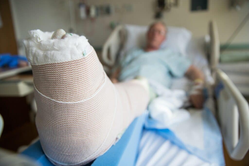 patient lying in hospital bed with broken leg bone wrapped in cast