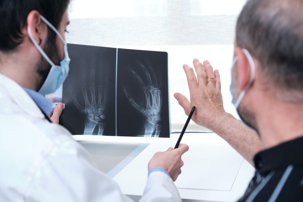 x ray of hand with arthritis